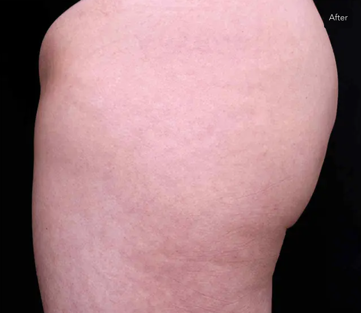 After consistent use