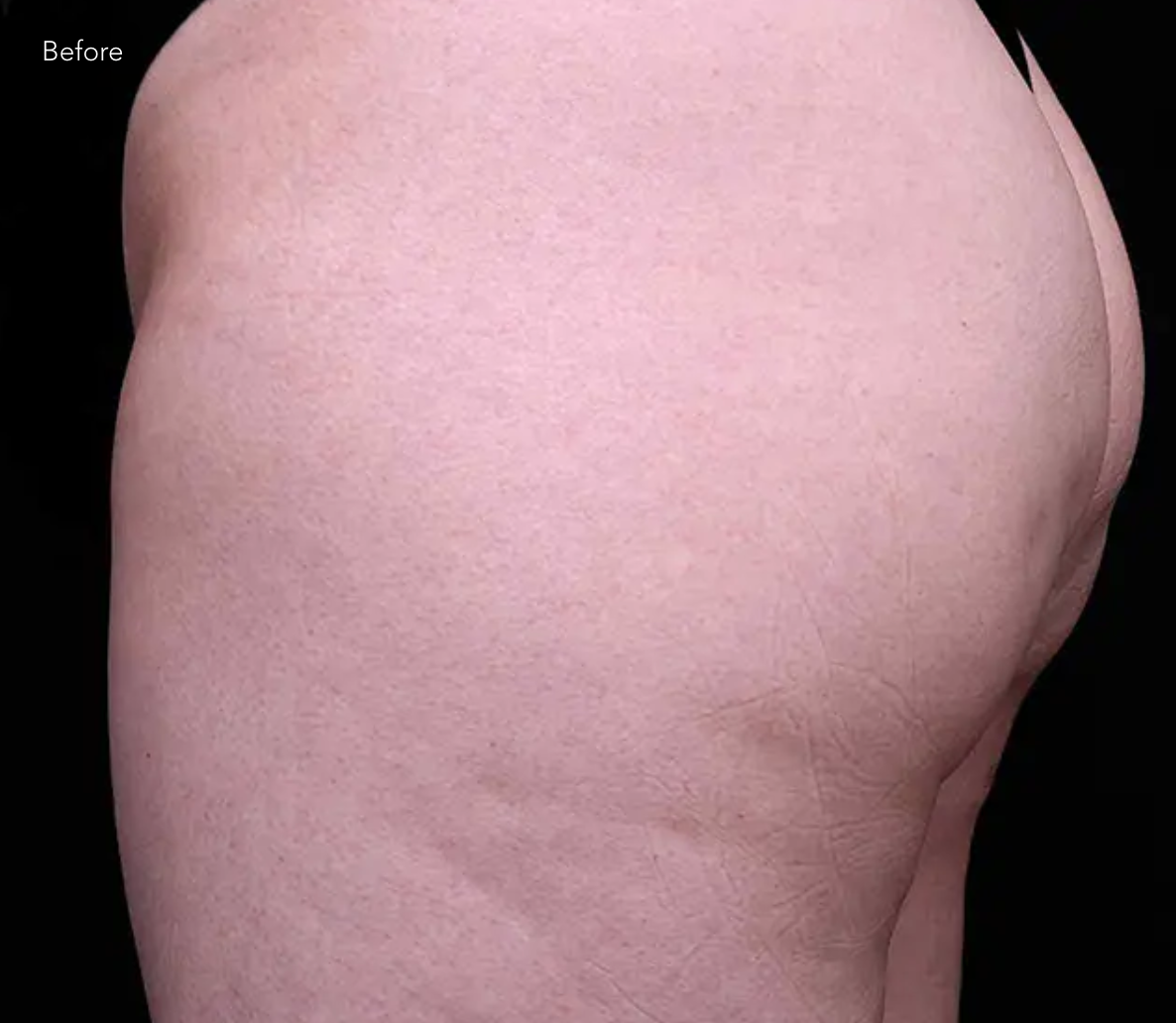 Before starting the routine